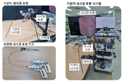 목에 걸린 이물질, '기관지 내시경 로봇'으로 바로 꺼낸다